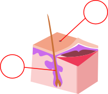 skin